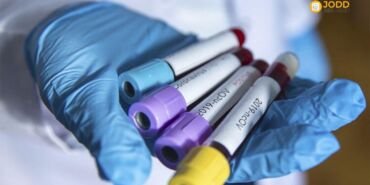 koronavirus iran 2 kisi oldu