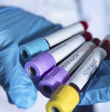 koronavirus iran 2 kisi oldu