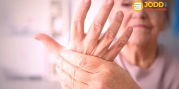 Romatoid Artrit nedir