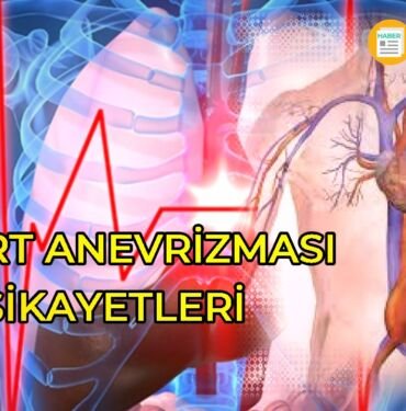 Aort anevrizması şikayetleri