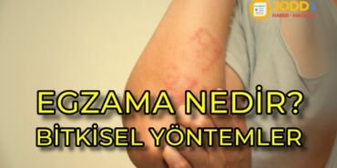 egzama nedir