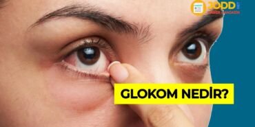 Glokom göz tansiyonu nedir?
