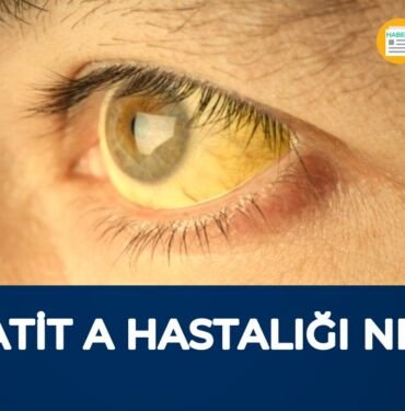 hepatit a nedir