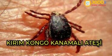Kırım kongo belirtileri nelerdir?