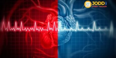 mitral kapak hastaliklari