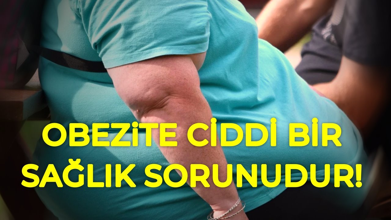 Obezite ciddi bir sağlık sorunudur, hastalıktır.