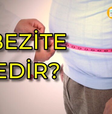 obezite nedir
