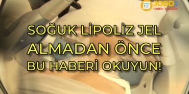 soğuk lipoliz jel kullananlar