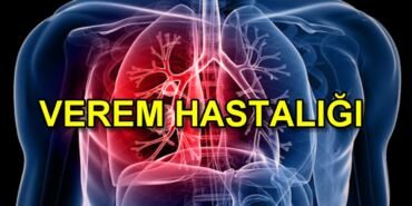 Verem hastalığı nedir?