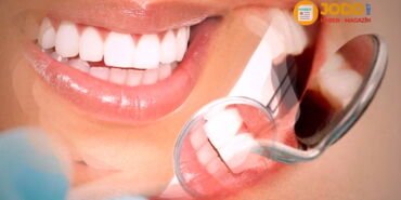 Dişler neden sararır?