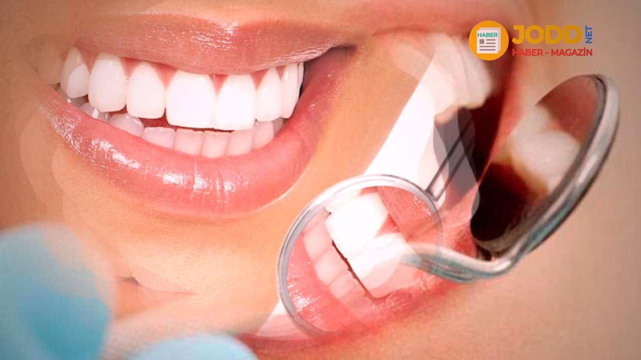 Dişler neden sararır?