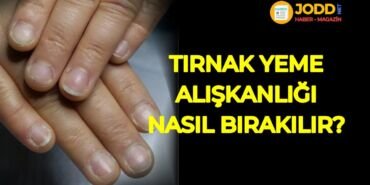 Tırnak yeme alışkanlığı nasıl bırakılır?