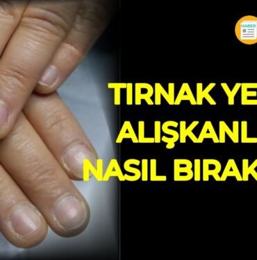 Tırnak yeme alışkanlığı nasıl bırakılır?