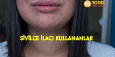 roaccutane kullanıcı yorumları