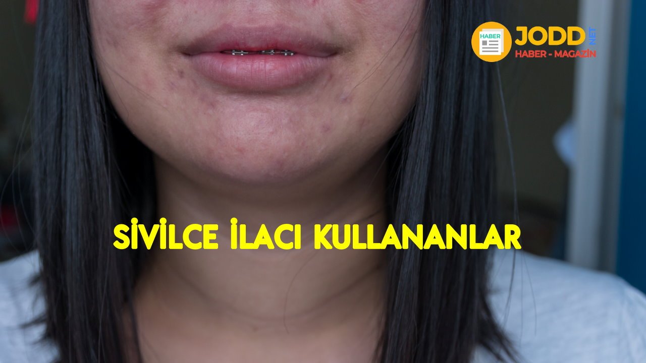 roaccutane kullanıcı yorumları