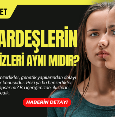 ikizlerin parmak izleri ayni midir