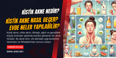 kistik akne nedir