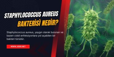 Staphylococcus aureus nedir
