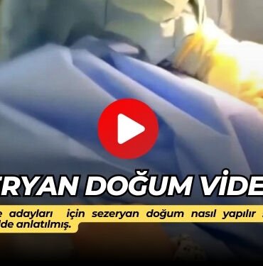 sezeryan dogum ani videosu izle
