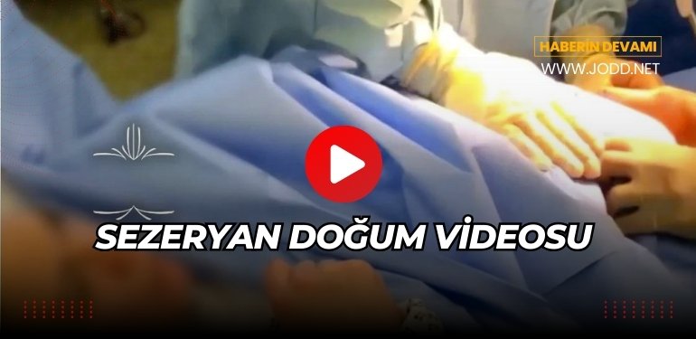 sezeryan dogum anı videosu