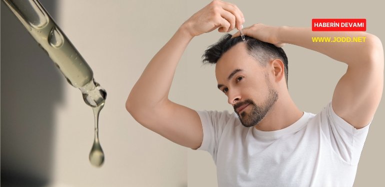 sac cikaran serum kullananlar