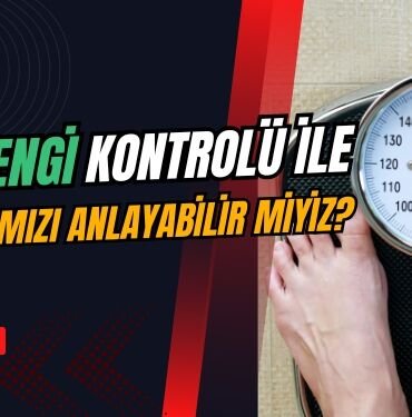 idrar rengi ile zayiflama kontrolu